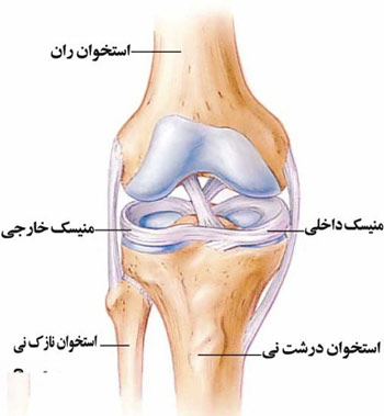 پارگی مینیسک زانو, درمان پارگی مینیسک زانو, علل پارگی پارگی مینیسک