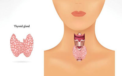 تغذیه سالم,اختلالات تیروئید